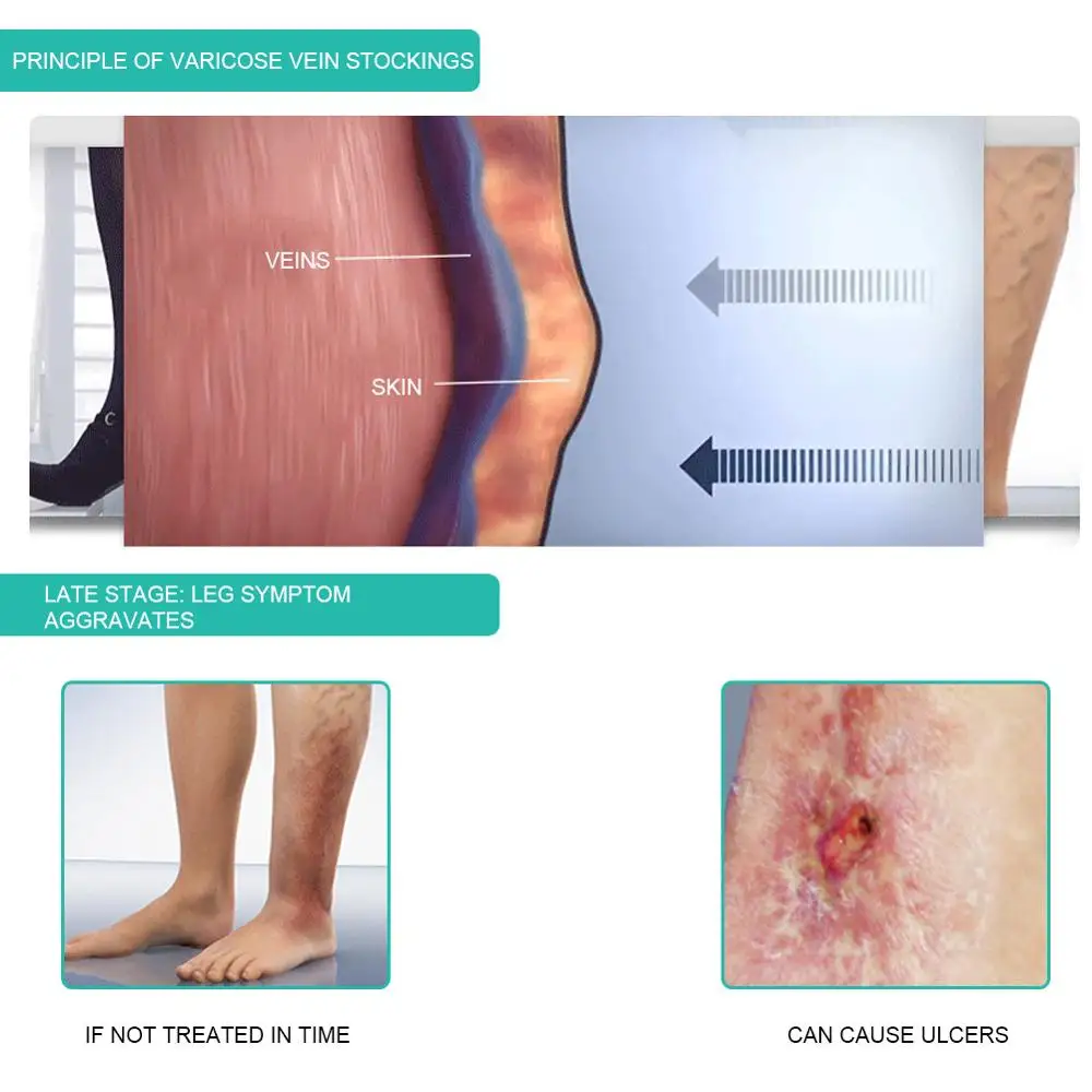 1คู่ถุงเท้าการบีบอัดทางการแพทย - Compression Sleeve Calf บทวิจารณ์และราคา